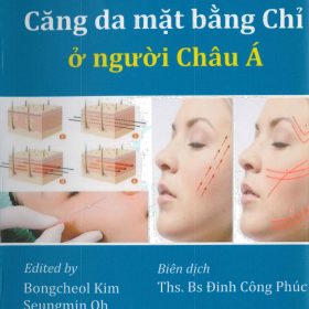 Căng Da Mặt Bằng Chỉ ở Người Châu Á