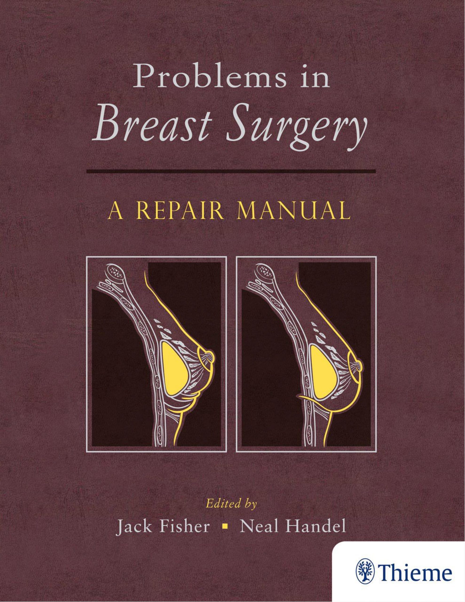 Sách Problems in Breast Surgery: A Repair Manual