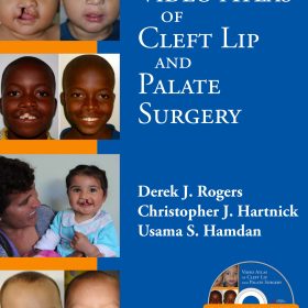 Video Atlas of Cleft Lip and Palate Surgery (2014) Tác giả chính: Derek J. Rogers, Christopher J. Hartnick, Usama S. Hamdan Nhà xuất bản: Plural Publishing