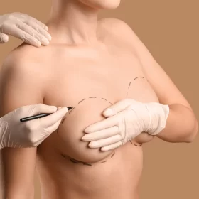 Phụ nữ đang giữ được vòng một săn chắc mà không cần mặc áo ngực nhờ một phương pháp phẫu thuật mới đang gây sốt. Không áo ngực? Không vấn đề.