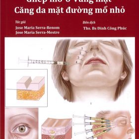 Kỹ Thuật Ghép mỡ ở vùng mặt Căng da mặt đường mổ nhỏ – Jose Maria Serra-Renom, Jose Maria Serra-Mestre