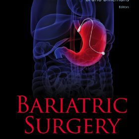 Phẫu thuật giảm béo (Bariatric Surgery) – Nadey S Hakim, Franco Favretti, Gianni Segato, Bruno Dillemans