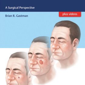 Cutaneous Malignancies A Surgical Perspective – Brian R. Gastman, Neilendu Kundu