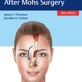 Facial Reconstruction After Mohs Surgery – James F. Thornton, Jourdan A. Carboy