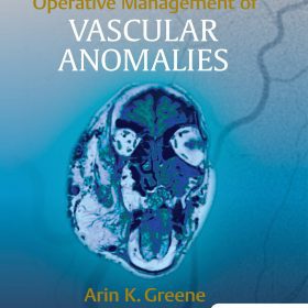 Operative Management of VASCULAR ANOMALIES – Arin K. Greene