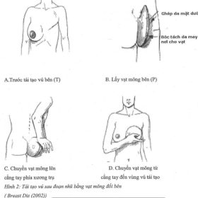 Giáo trình PTTHTM ĐH Y Dược TPHCM – Phần 2