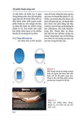 Bìa tài liệu Phẫu thuật thẩm mỹ khuôn mặt người Châu Á Phần 2 - Kỹ thuật mũi và môi