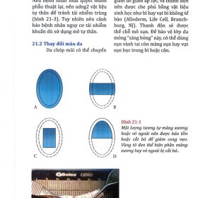 Phẫu thuật thẩm mỹ khuôn mặt người Châu Á (Phần 2): Kỹ thuật nâng mũi tự thân và thẩm mỹ môi – Jung I. Park & Dong Hak Jung