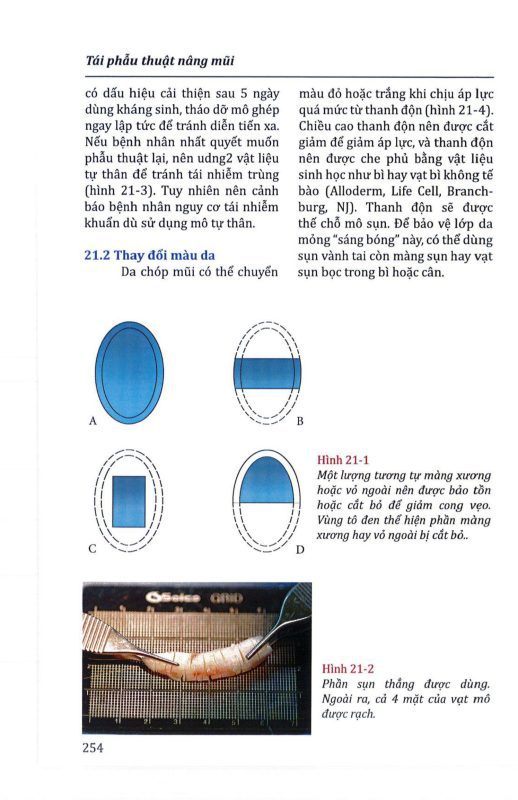 Bìa tài liệu Phẫu thuật thẩm mỹ khuôn mặt người Châu Á Phần 2 - Kỹ thuật mũi và môi