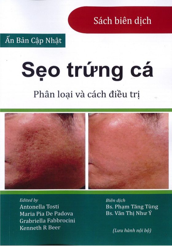 Bìa sách Sẹo trứng cá: Phân loại và cách điều trị, chủ biên Antonella Tosti