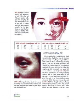 Căng da mặt với chất làm đầy Kyle K. Seo - Phần 2 - Kỹ thuật tiêm vùng mắt mũi cằm