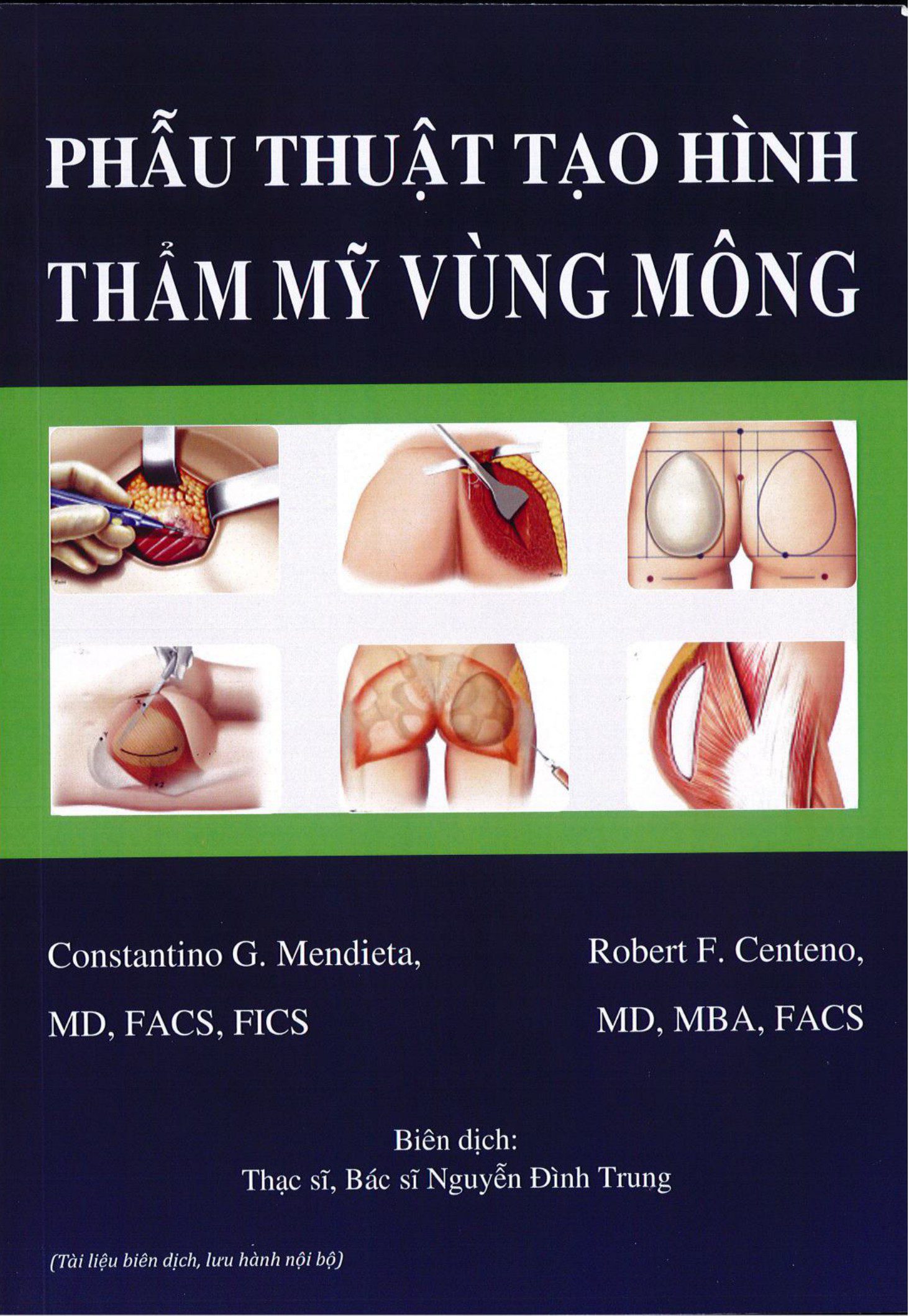 Bìa sách Phẫu Thuật Tạo Hình Thẩm Mỹ Vùng Mông của Constantino G. Mendieta và Robert F. Centeno.