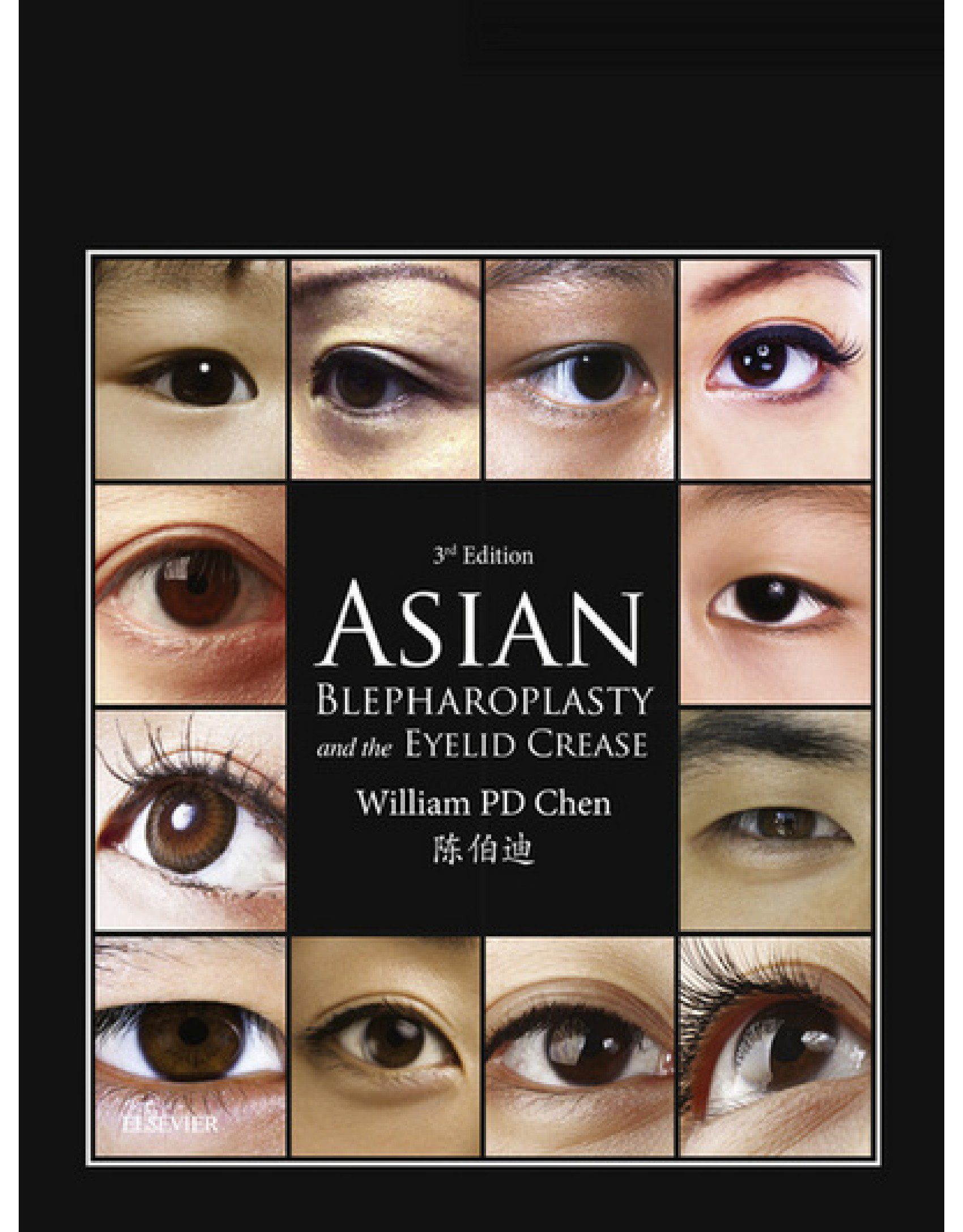 Asian Blepharoplasty and the Eyelid Crease