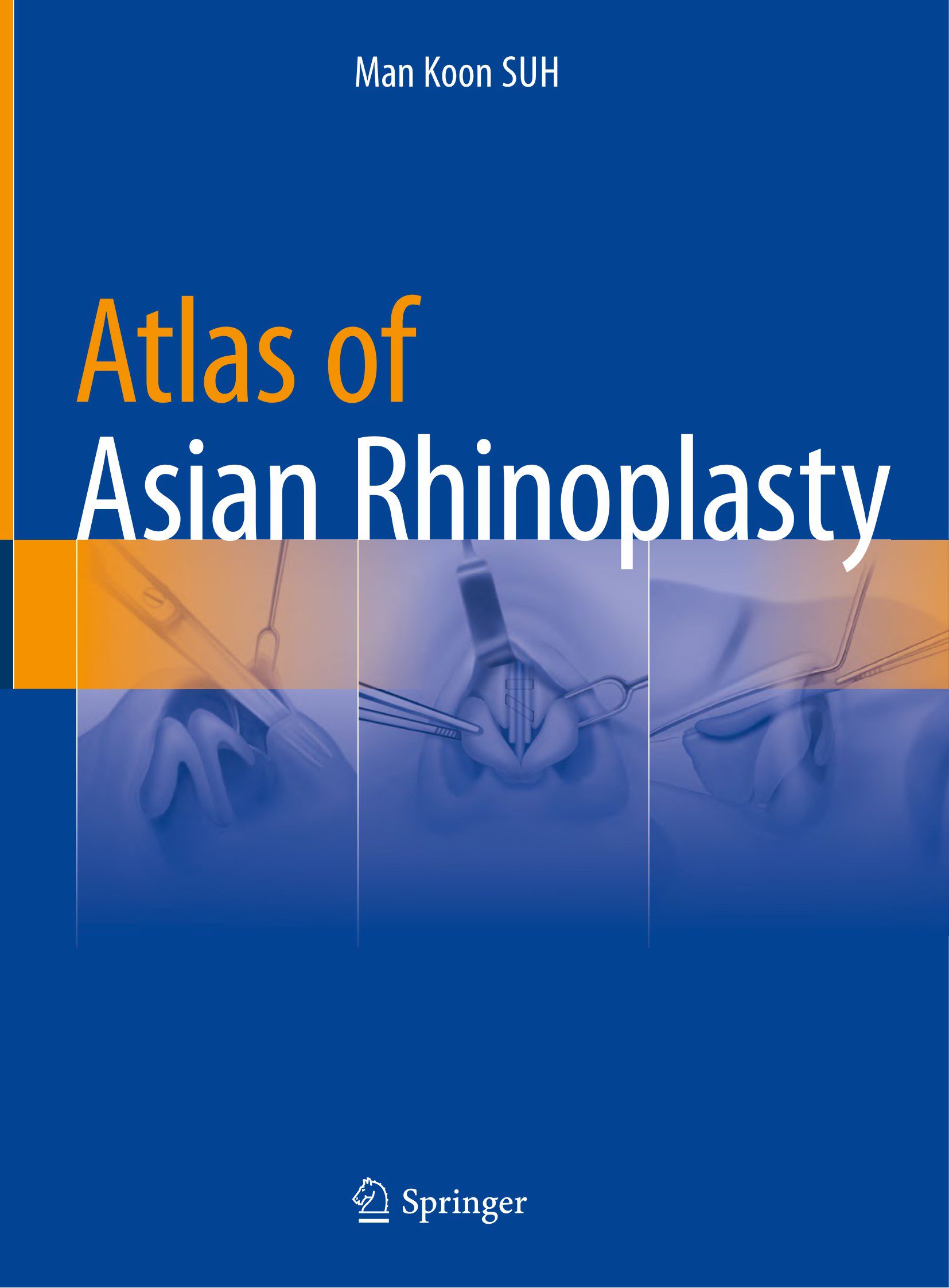 Atlas of Asian Rhinoplasty