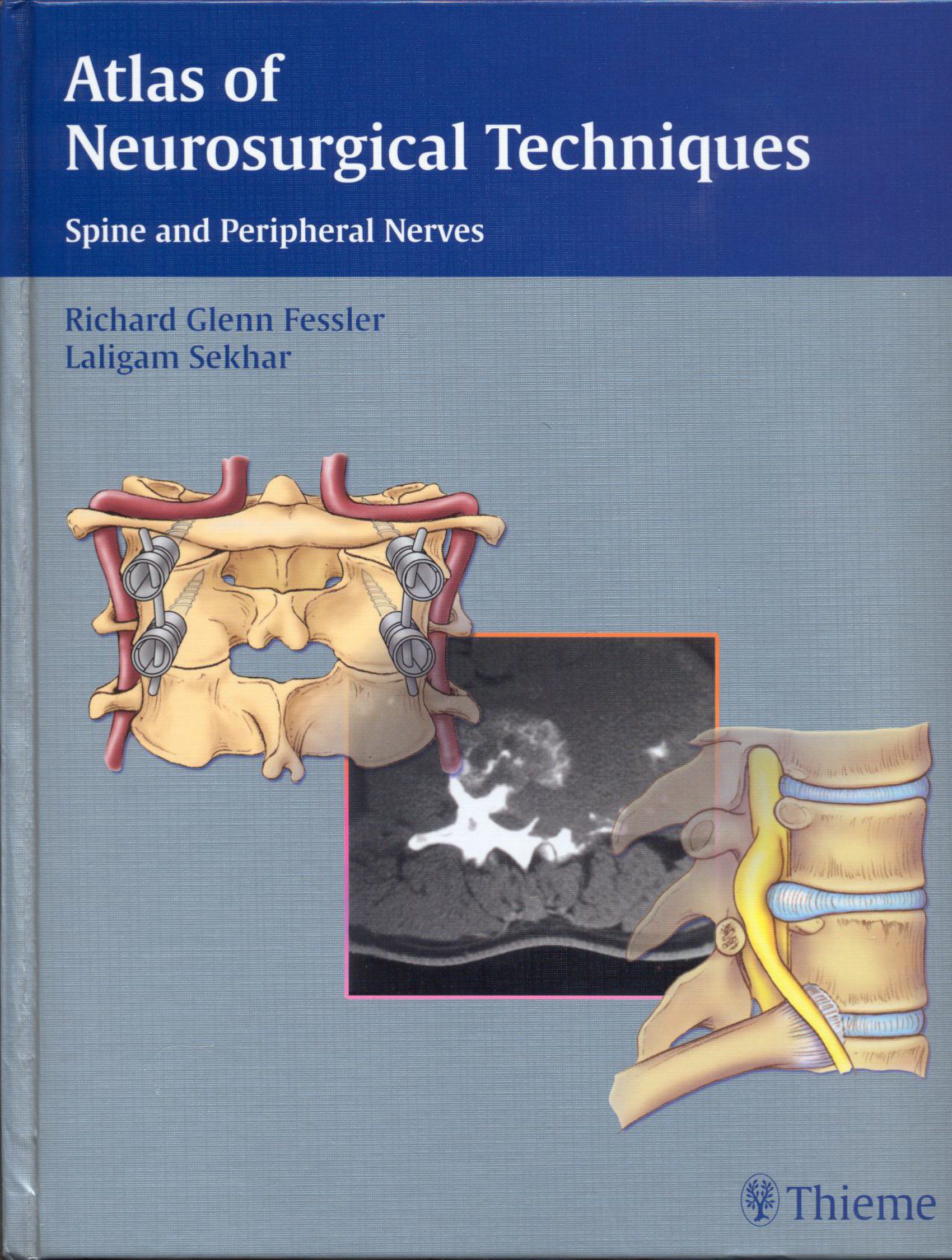Bìa sách Atlas of Neurosurgical Techniques Spine and Peripheral Nerves