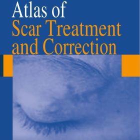 Atlas of Scar Treatment and Correction: Cẩm nang điều trị và sửa chữa sẹo – Dr. Igor Safonov