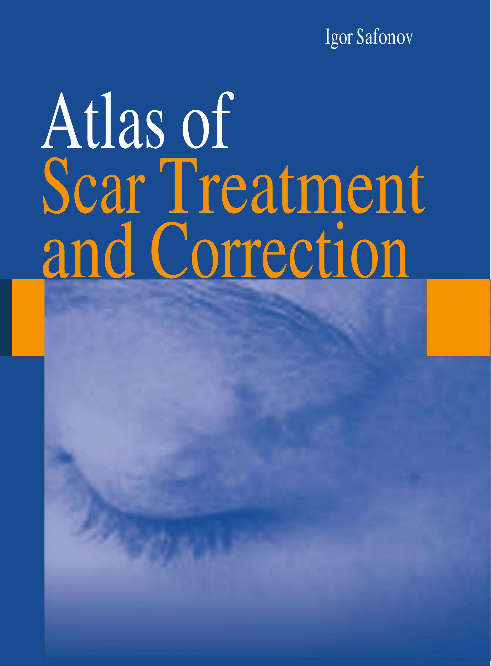 Bìa sách Atlas of Scar Treatment and Correction - Igor Safonov