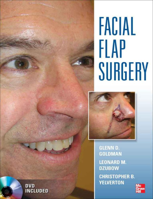 Bìa sách Facial Flap Surgery của Glenn D. Goldman, Leonard M. Dzubow, và Christopher B. Yelverton