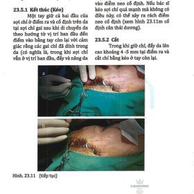 Aesthetic Oculofacial Rejuvenation: Tiếp cận toàn diện thẩm mỹ vùng mắt – Marian Cantisano-Zilkha