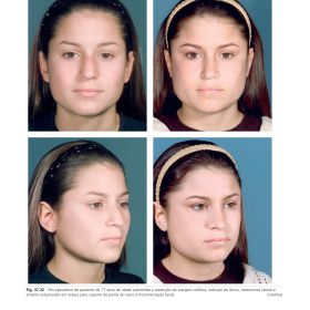 Cirurgia Plástica Estética: Princípios e Técnicas – Foad Nahai