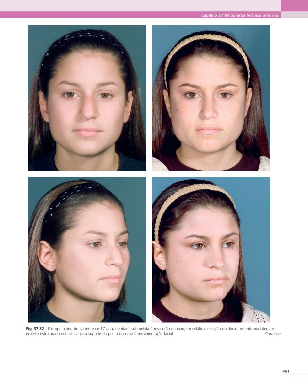 Cirurgia Plástica Estética: Princípios e Técnicas