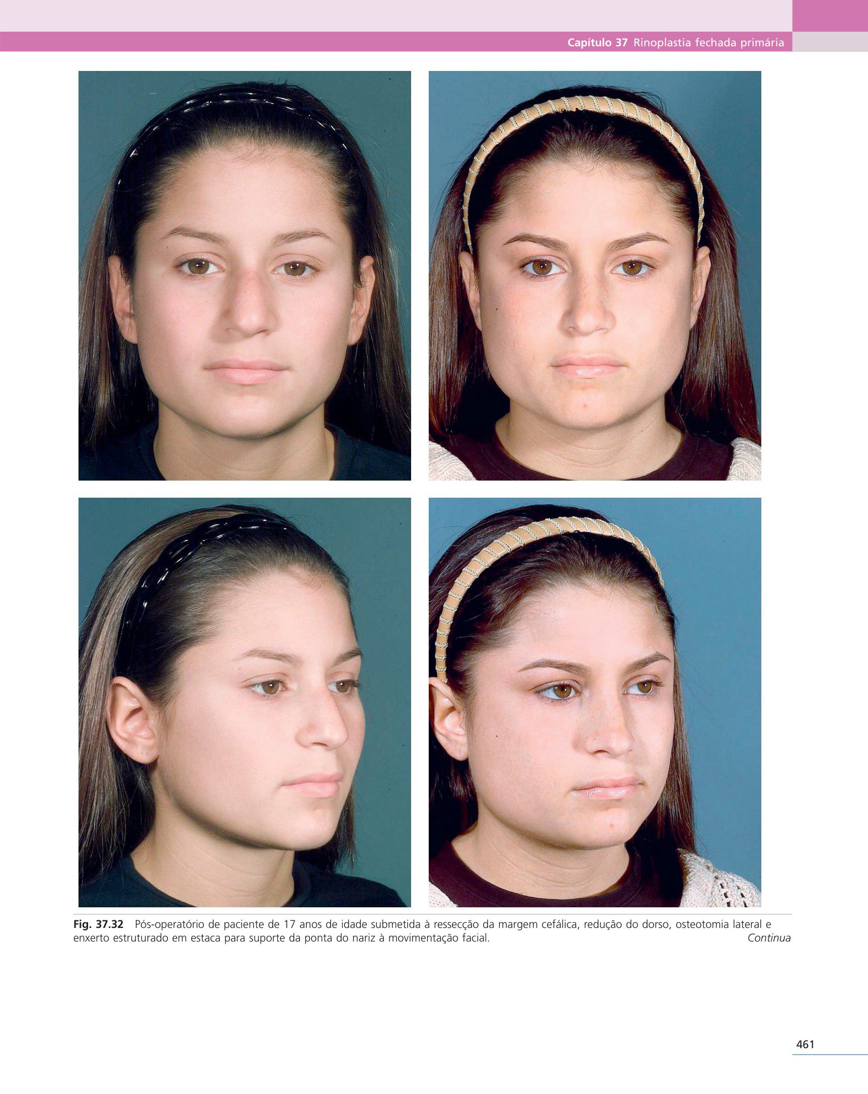 Cirurgia Plástica Estética: Princípios e Técnicas