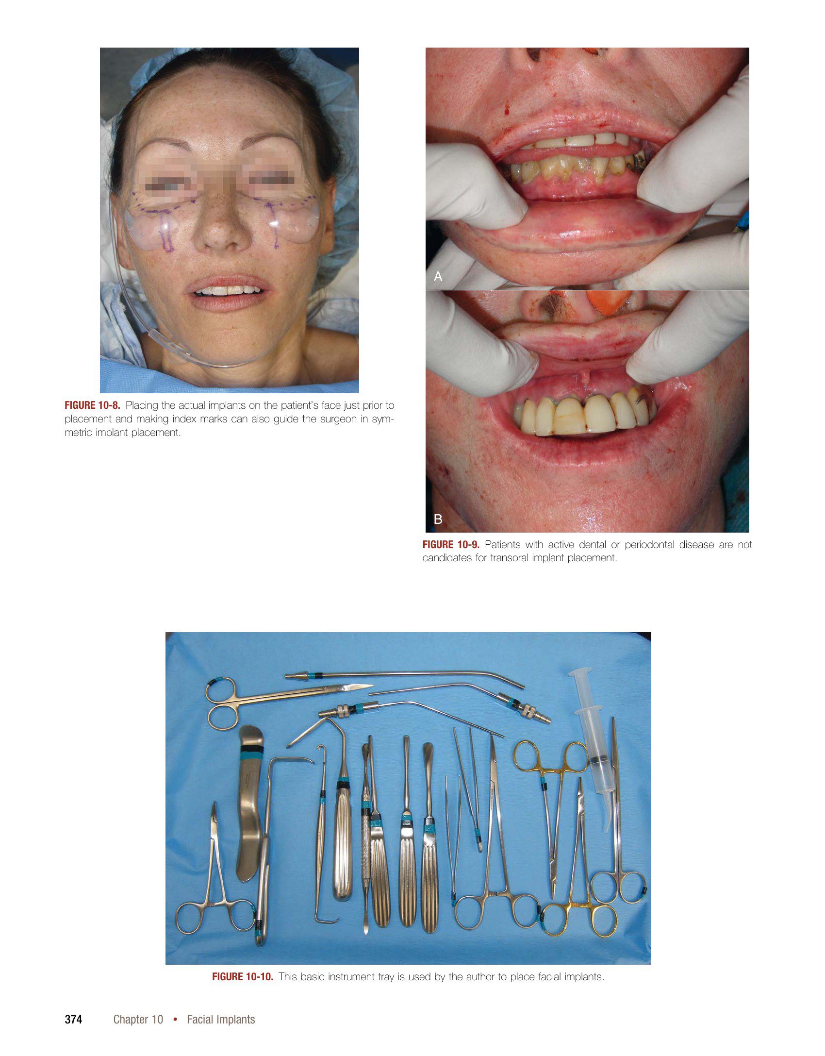 Sách Cosmetic Facial Surgery Joe Niamtu III