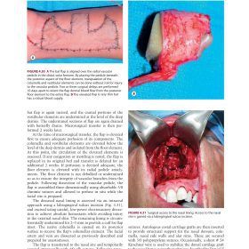 Head and Neck Reconstruction (Phần 2): Tái tạo Mũi, Môi, Hàm và Chấn thương Mặt – Peter C. Neligan