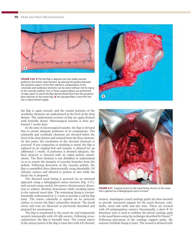 Head and Neck Reconstruction PDF part 2