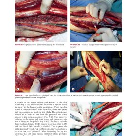 Head and Neck Reconstruction: Kỹ Thuật Phẫu Thuật Tái Tạo Đầu Cổ – Nhiều Tác Giả