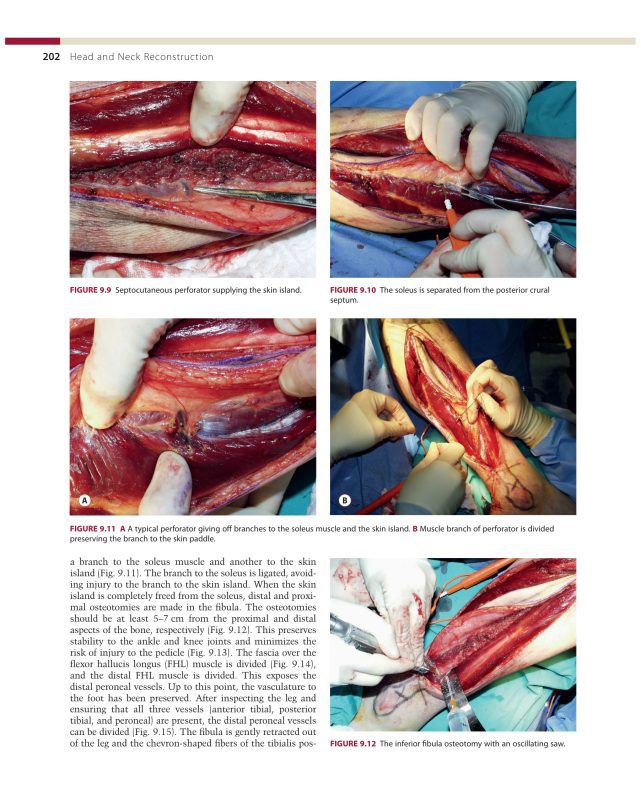Sách Head and Neck Reconstruction phẫu thuật tạo hình đầu mặt cổ
