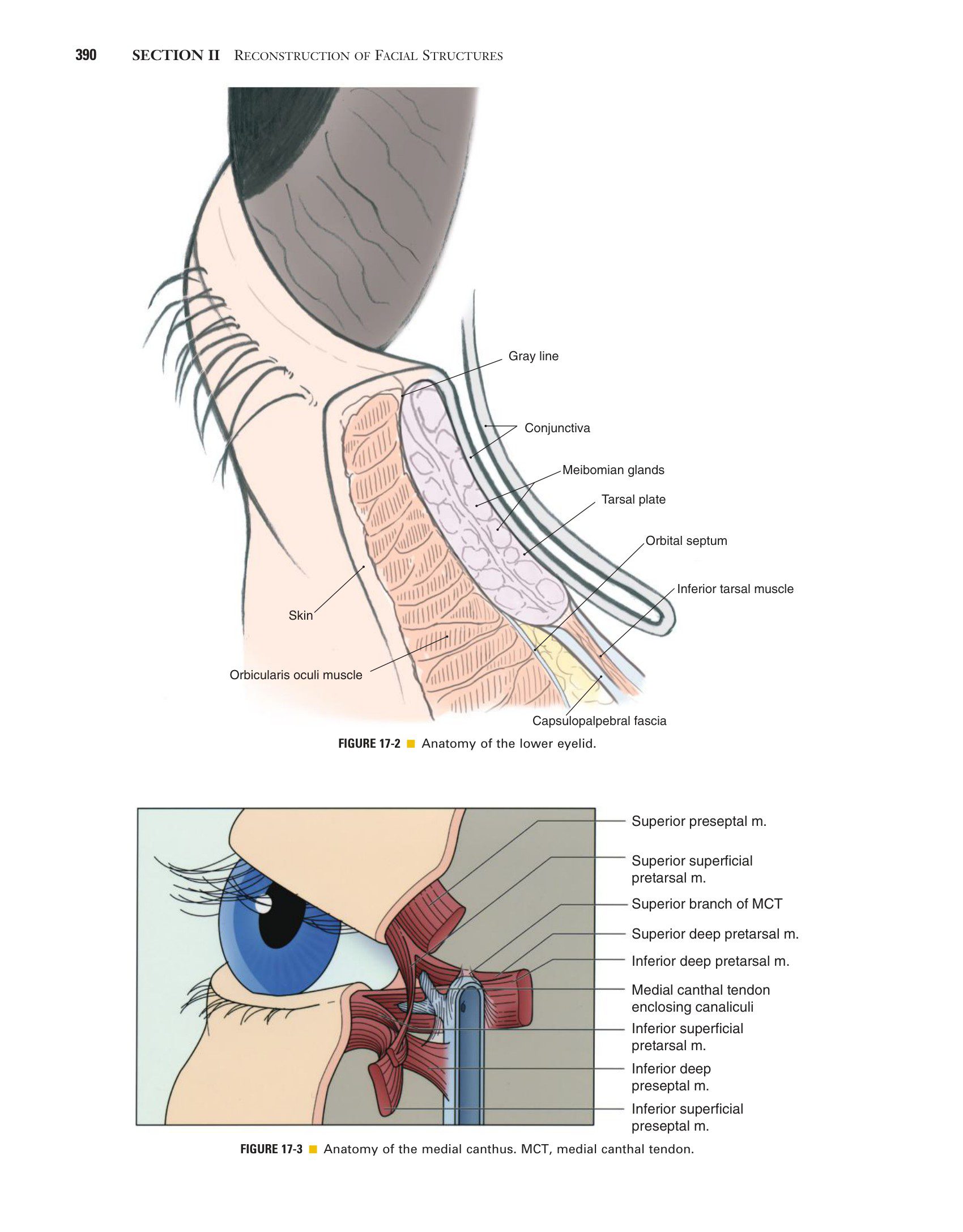 Local Flaps in Facial Reconstruction part 2
