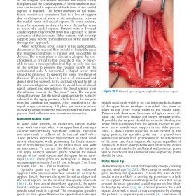 [Ebook] Master Techniques in Facial Rejuvenation (Phần 5): Chiến lược Nâng mũi & Trẻ hóa mũi cho Bệnh nhân Lớn tuổi