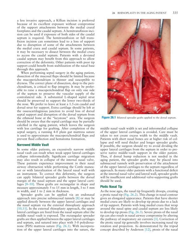 Sách Master Techniques in Facial Rejuvenation - Chương 26: Phẫu thuật nâng mũi cho người lớn tuổi