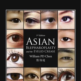 Asian Blepharoplasty and the Eyelid Crease: Sách chuyên sâu Phẫu thuật Tạo mí mắt người Châu Á, tái bản lần 3 – William PD Chen