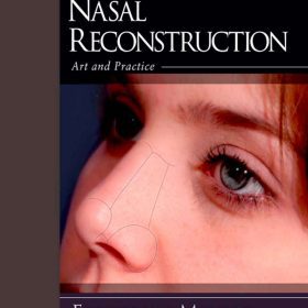 Nasal Reconstruction Art and Practice: Kiệt tác về nghệ thuật và kỹ thuật tái tạo mũi – Frederick J. Menick