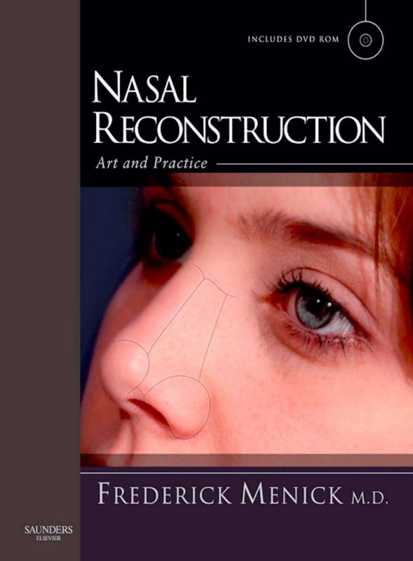 Bìa sách Nasal Reconstruction Art and Practice của Frederick J. Menick - Tài liệu tái tạo mũi chuyên sâu