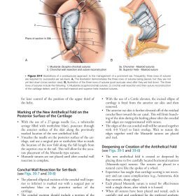 Orthognathic Surgery (Part 7): Tạo hình tai vểnh & Trẻ hóa mô mềm mặt cổ – Jeffrey C. Posnick