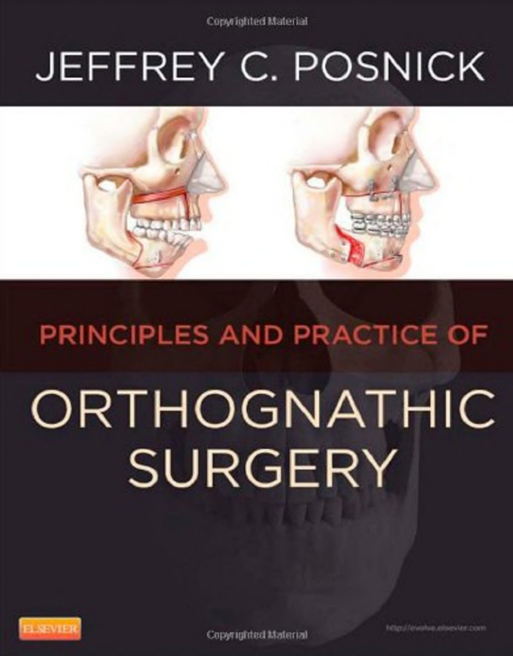 Bìa sách Orthognathic Surgery Principles and Practice Part 1