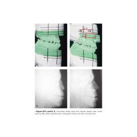 Orthognathic Surgery Principles and Practice: Nguyên lý và Thực hành Phẫu thuật Chỉnh hình Xương hàm – Jeffrey C. Posnick