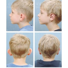 Orthognathic Surgery: Principles and Practice: Hướng dẫn toàn diện về chỉnh hình hàm mặt – Jeffrey C. Posnick