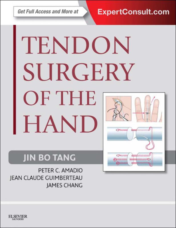 Bìa sách Tendon Surgery of the Hand của Jin Bo Tang