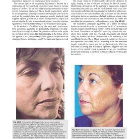 The Art of Aesthetic Surgery: Principles and Techniques: Hướng dẫn toàn diện về trẻ hóa mặt và cổ – Foad Nahai