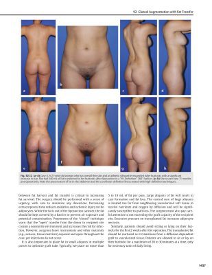 The Art of Aesthetic Surgery Principles and Techniques Volume 3 Part 3 Foad Nahai Body Contouring Genital Rejuvenation