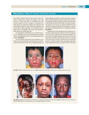 Bìa tài liệu Bỏng Vùng Mặt - Trích từ The Unfavorable Result in Plastic Surgery