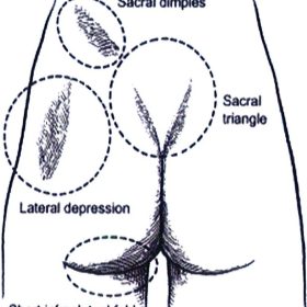 Giải phẫu ứng dụng trong phẫu thuật tạo hình thẩm mỹ vùng mông